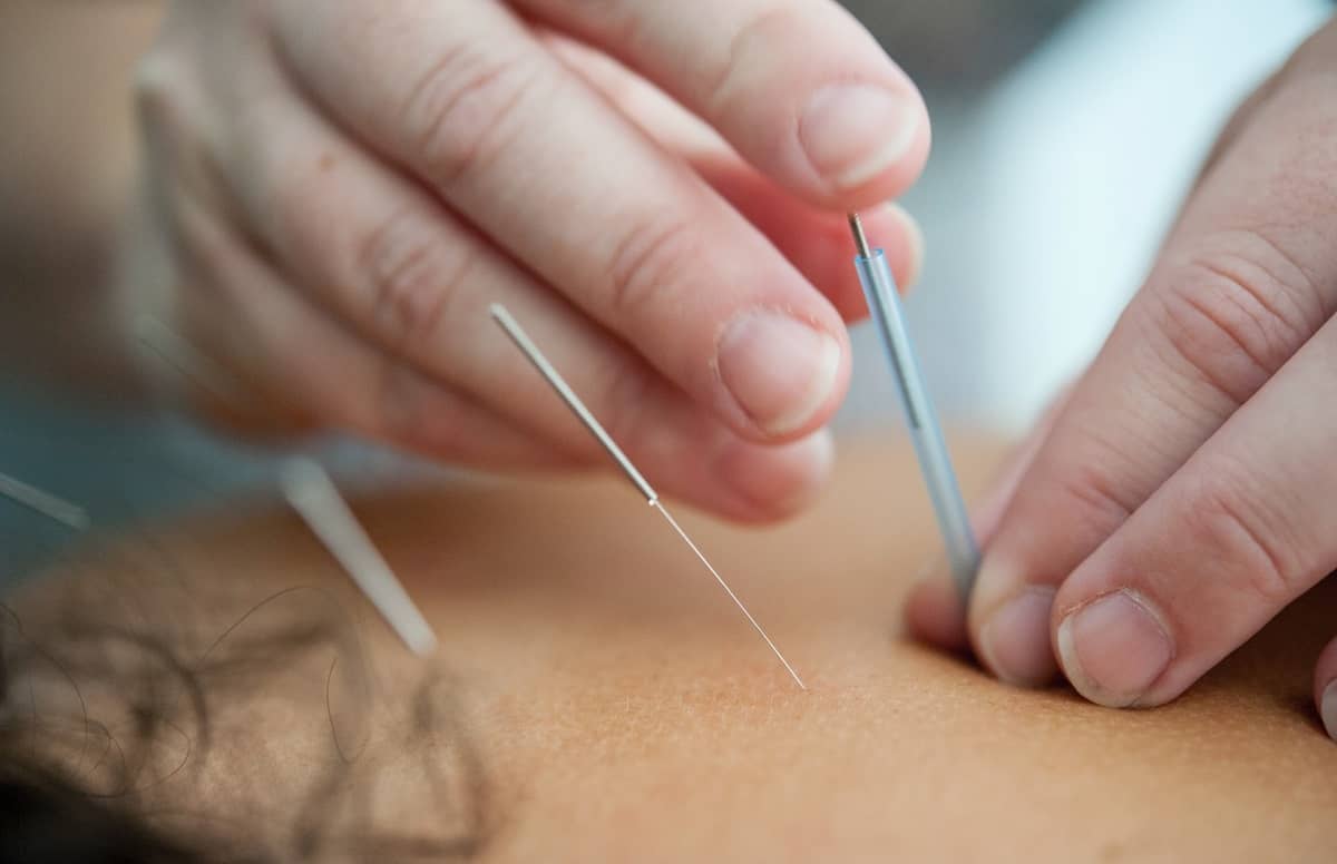 Acupuncture for alcoholism and drug addiction